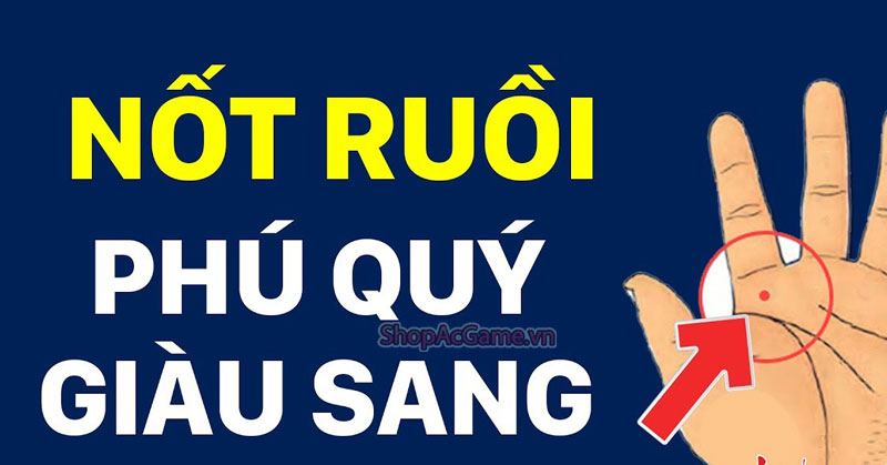 Nốt Ruồi Bàn Tay Quý Nhân Vượng Vận